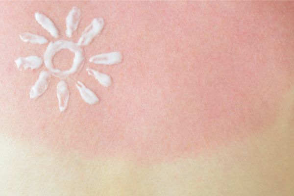 ProtectingSkinBlog DosDonts